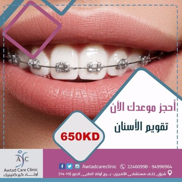 تقويم الأسنان | عيادة أسنان فى الكويت | عيادة أوتاد كير الطبية